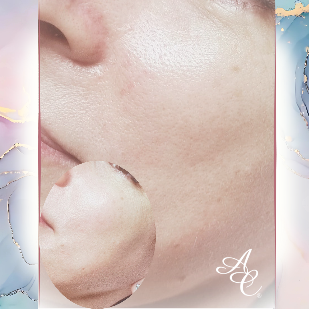 Soin Visage SOTHYS Feyzin